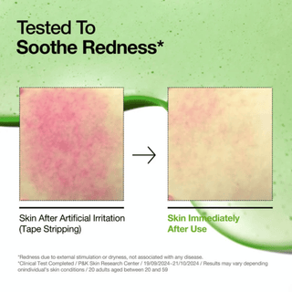 Anua Azelaic Acid 10 Hyaluron Redness Soothing Serum 30ml