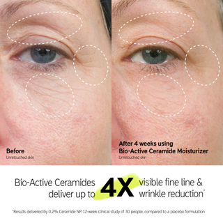 Visible reduction in lines and wrinkles after 4 weeks use of Inkey List Bio-Active Ceramide moisturiser