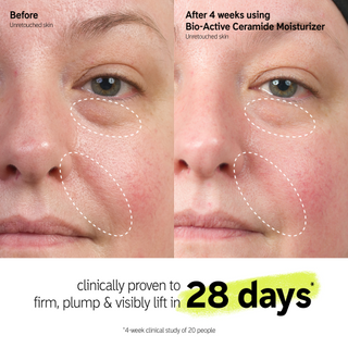Visible reduction in lines and wrinkles after 4 weeks use of Inkey List Bio-Active Ceramide moisturiser